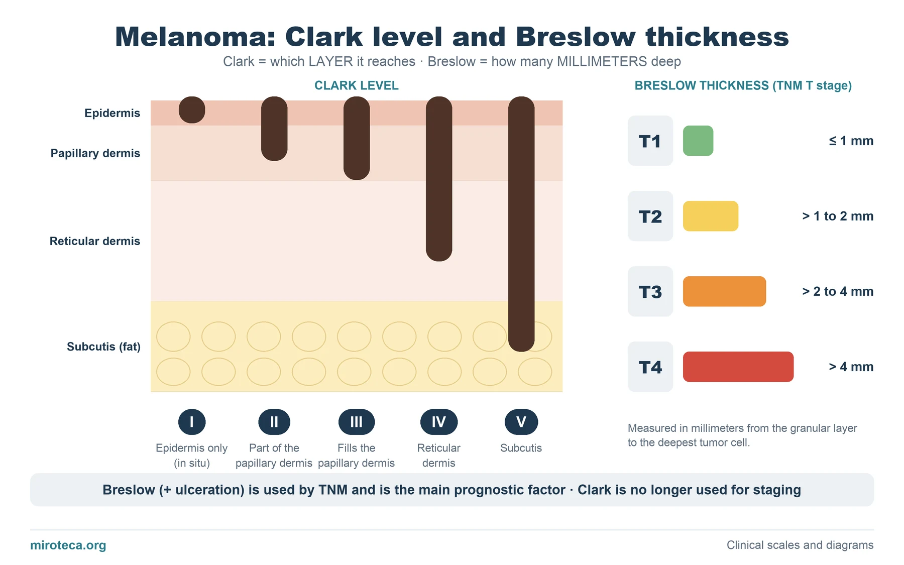 Diagram of a skin section with the five Clark levels of melanoma and bars showing the Breslow thickness cut-offs that define T1, T2, T3 and T4