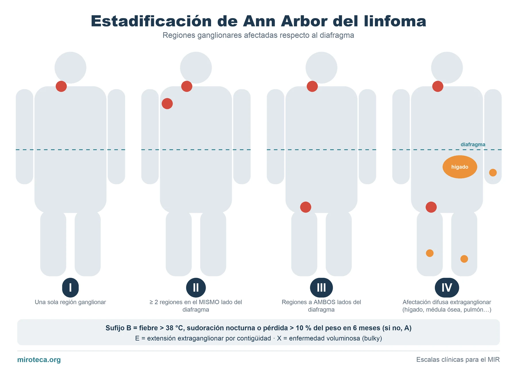 Cuatro siluetas con ganglios afectados en rojo y el diafragma marcado que muestran los estadios I, II, III y IV de Ann Arbor del linfoma