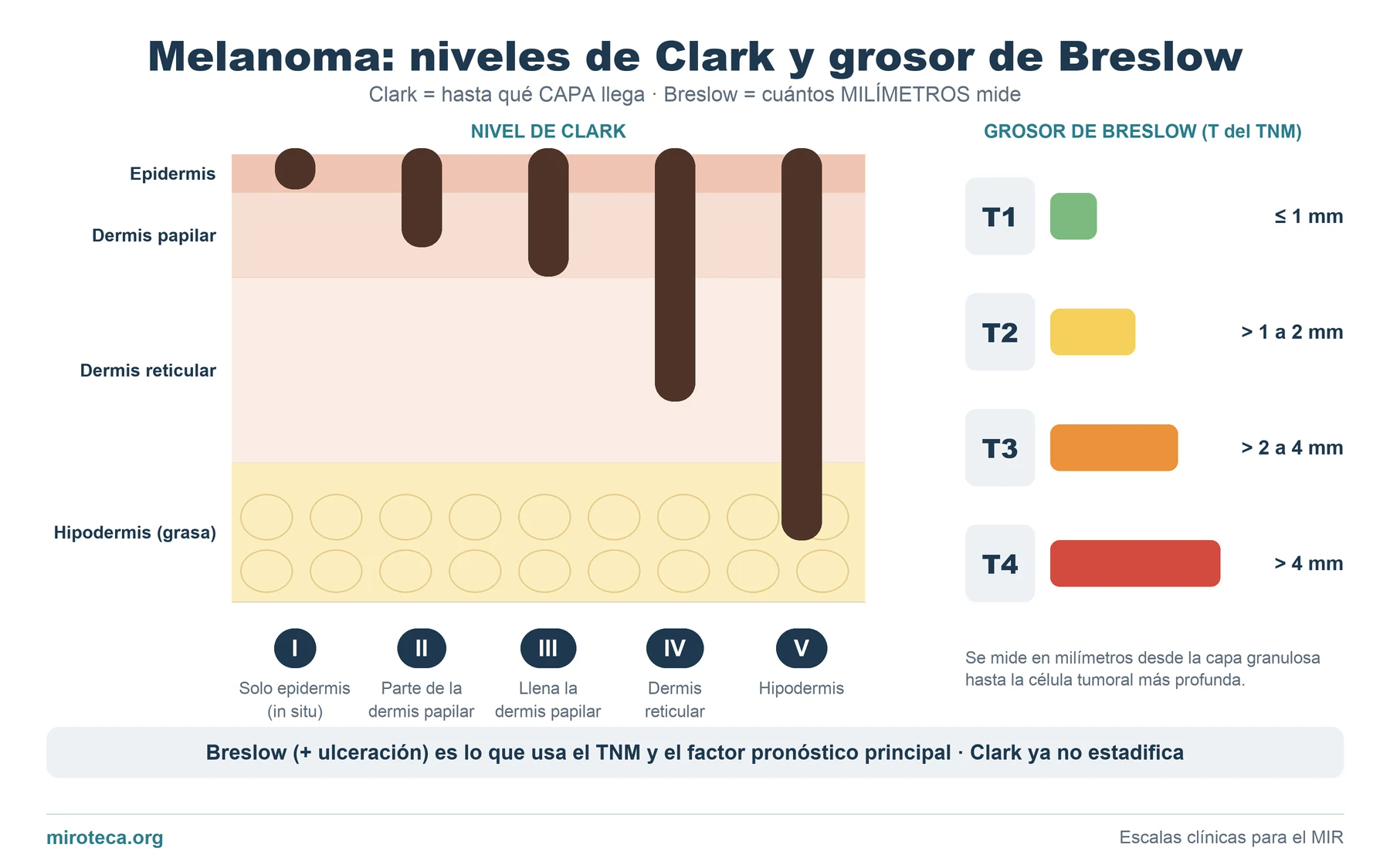 Esquema de un corte de piel con los cinco niveles de Clark del melanoma y barras con los grosores de Breslow que definen T1, T2, T3 y T4