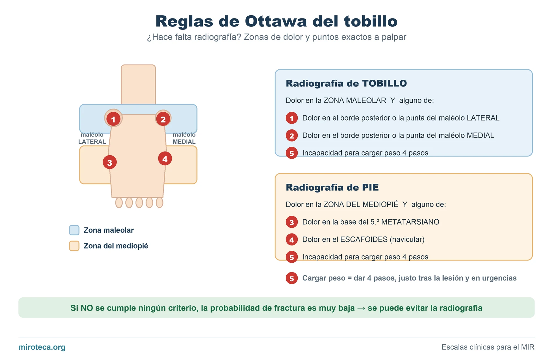 Reglas de Ottawa del tobillo: zonas maleolar y del mediopié con los cuatro puntos a palpar para decidir si hace falta radiografía