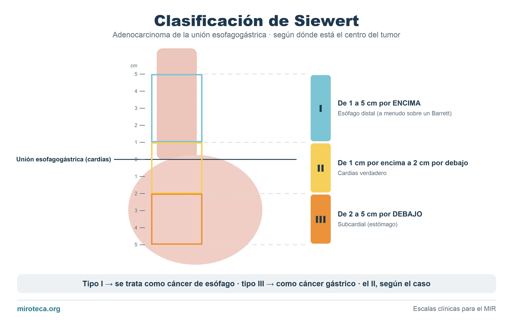 Esquema del esófago distal y el estómago con una regla en centímetros que marca las zonas de los tipos I, II y III de Siewert respecto a la unión esofagogástrica