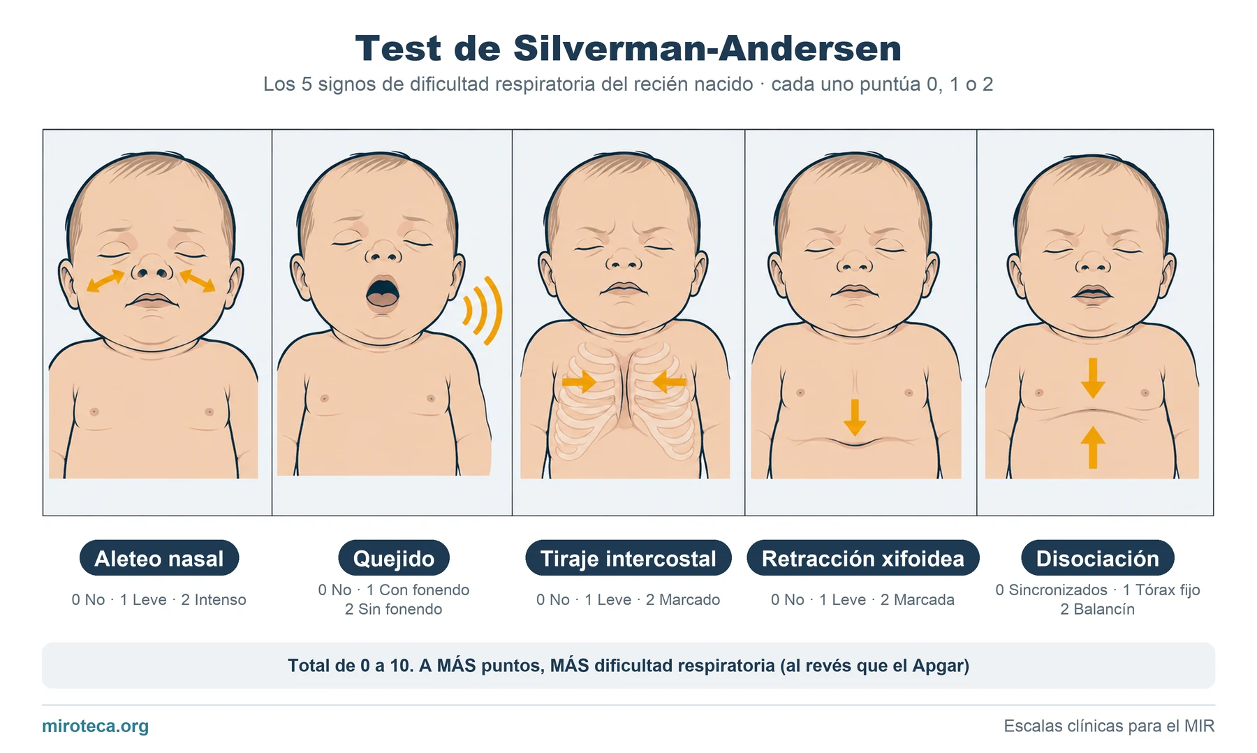 Test de Silverman-Andersen: los 5 signos de dificultad respiratoria del recién nacido — aleteo nasal, quejido espiratorio, tiraje intercostal, retracción xifoidea y disociación toracoabdominal