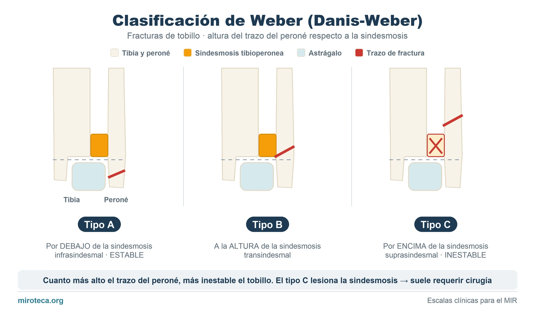 Clasificación de Weber o Danis-Weber: fracturas de tobillo tipo A, B y C según la altura del trazo del peroné respecto a la sindesmosis tibioperonea