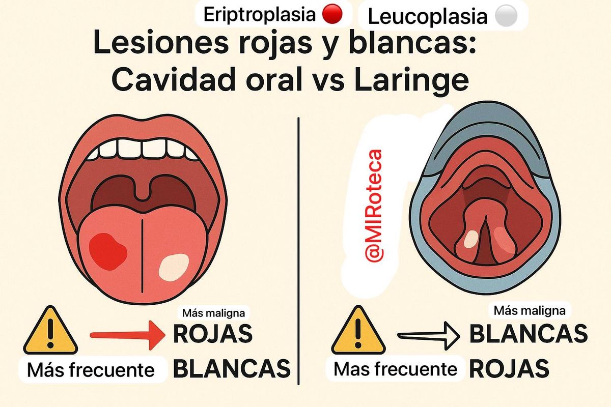Lesiones rojas y blancas: cavidad oral vs laringe